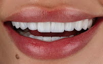 DENTAL & DESIGN GROUP - Expertos en Diseños de Sonrisa, Carillas Dentales - Madrid
