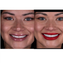 Clínica Dental Sante en Chamberi