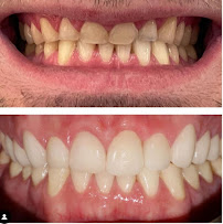 Clínica Dental Sante en Chamberi