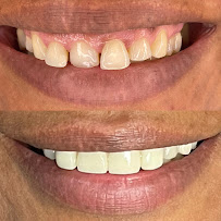 Clínica Dental Sante en Chamberi