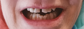 Clínica ASISA Dental