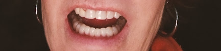 Clínica ASISA Dental