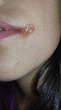 Clínica ASISA Dental