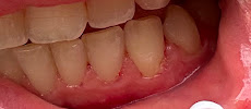 Sanitas Milenium Castelló Dental Clinic