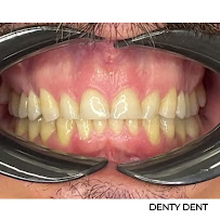 Denty Dent - Bravo Murillo Dental Clinic in Madrid