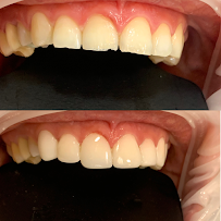 Denty Dent - Bravo Murillo Dental Clinic in Madrid