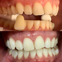 Denty Dent - Bravo Murillo Dental Clinic in Madrid