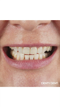 Denty Dent - Bravo Murillo Dental Clinic in Madrid