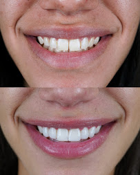 Denty Dent - Bravo Murillo Dental Clinic in Madrid
