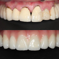 Clínica Dental Reina Victoria 66