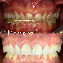Clínica Dental Reina Victoria 66
