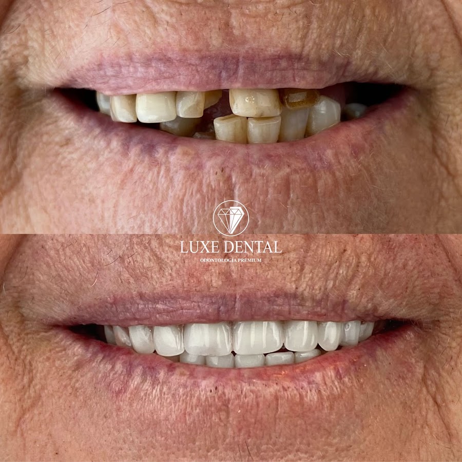 Clínica Luxe Dental Madrid - dental clinic in Madrid, Spain