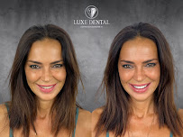 Clínica Luxe Dental Madrid