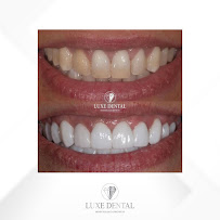 Clínica Luxe Dental Madrid