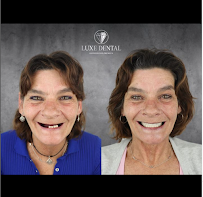 Clínica Luxe Dental Madrid