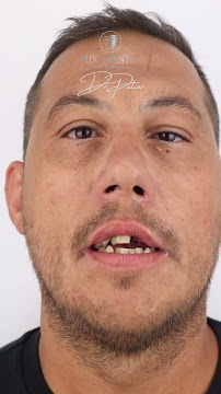 Clínica Luxe Dental Madrid