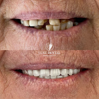 Clínica Luxe Dental Madrid in Madrid