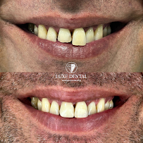 Clínica Luxe Dental Madrid