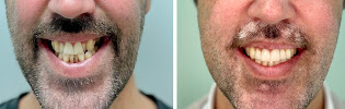 Clínica CS dental dentista en Prosperidad Madrid