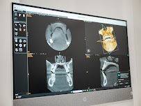 Clínica CS dental dentista en Prosperidad Madrid