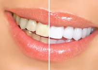 Clínica Dental en Las Rosas | Dental Familia