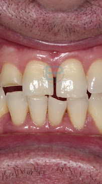 Centro Dental Internacional. Implantes dentales. Ortodoncia. Estetica dental. Odontopediatra.Blanqueamiento. Carillas