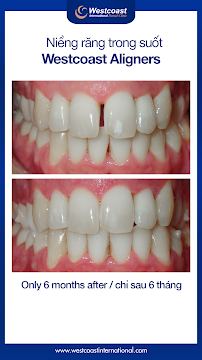 Westcoast International Dental Clinic (West Lake - Hanoi)