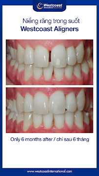 Westcoast International Dental Clinic (West Lake - Hanoi)