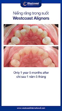 Westcoast International Dental Clinic (West Lake - Hanoi)
