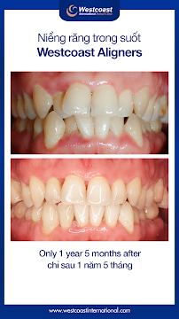 Westcoast International Dental Clinic (West Lake - Hanoi)