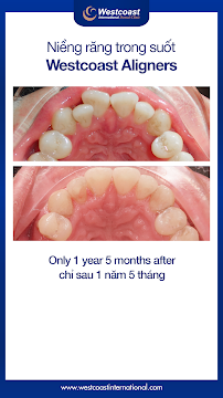 Westcoast International Dental Clinic (West Lake - Hanoi)