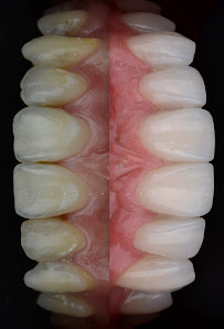 Dental Design Clinic Phuket town เด็นทัลดีไซน์คลินิก สาขาเมืองภูเก็ต