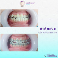 Nha khoa Sài Gòn New Đà Lạt, 245 Bùi Thị Xuân