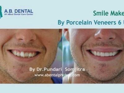 AB Dental Clinic Phuket in Phuket, Thailand, photograph 8