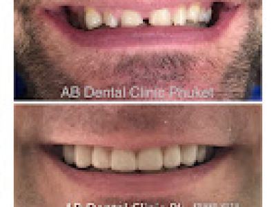 AB Dental Clinic Phuket in Phuket, Thailand, photograph 7