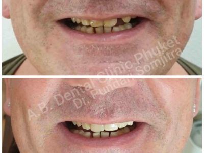 AB Dental Clinic Phuket in Phuket, Thailand, photograph 9