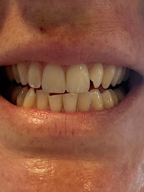 AB Dental Clinic Phuket One stop dental services. At AB Dental, we make your dental visit comfortable.