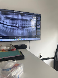 Hoan My Dental Clinic - Yenle Dental