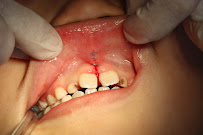 Nha khoa Dũng Hương