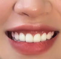 A Chau Cosmetic Dental