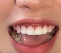 A Chau Cosmetic Dental