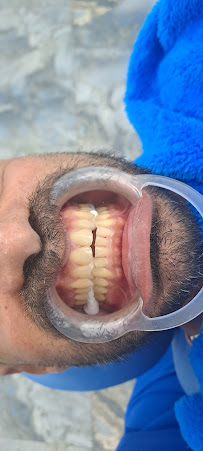 A Chau Cosmetic Dental