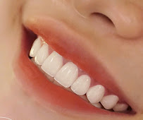 A Chau Cosmetic Dental