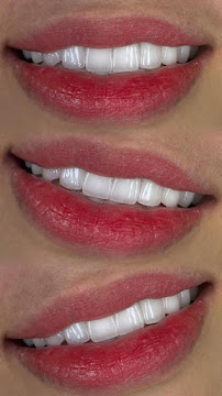 Nha Khoa Quốc tế DALA Quy Nhơn