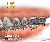 Nha Khoa Thẩm Mỹ Huỳnh Kim Dental - Nha Khoa Quy Nhơn Uy Tín