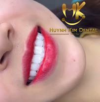 Nha Khoa Thẩm Mỹ Huỳnh Kim Dental - Nha Khoa Quy Nhơn Uy Tín