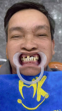 Nha Khoa Thẩm Mỹ Huỳnh Kim Dental - Nha Khoa Quy Nhơn Uy Tín