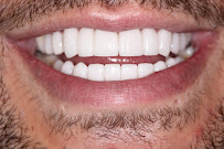 DENTALJOY PHUKET CLINIC