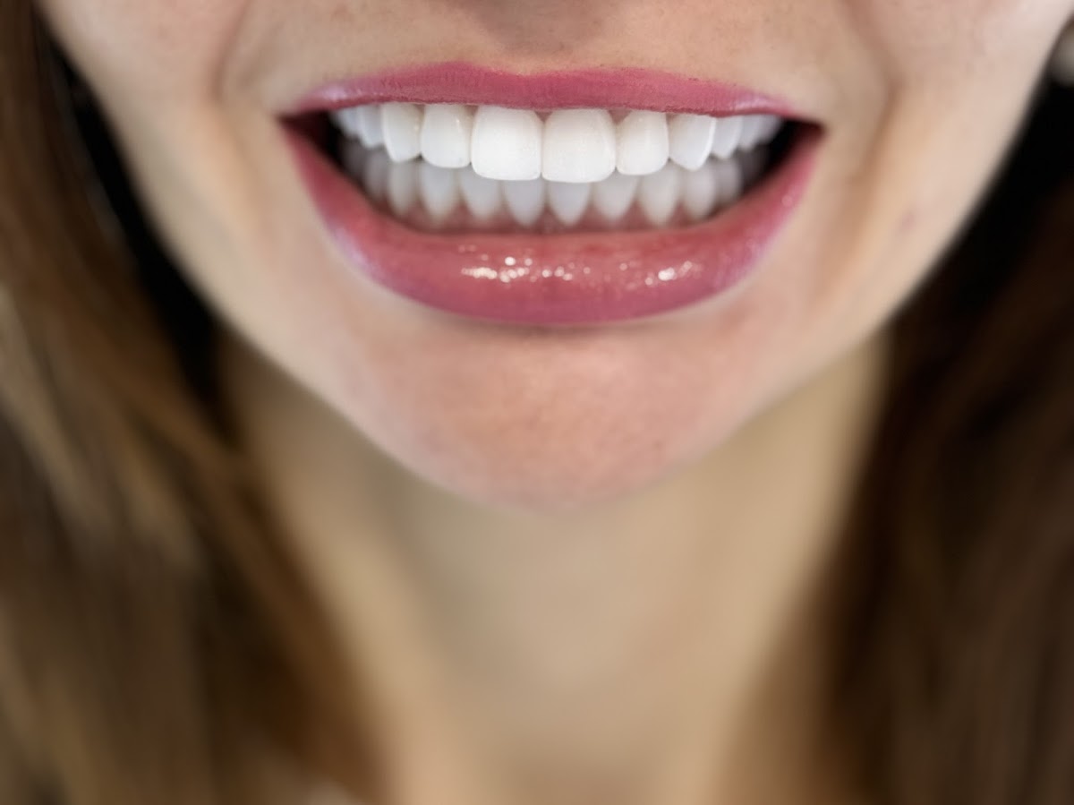 Dental Clinic in Batumi - ROLI DENT - dental clinic in Batumi, Georgia