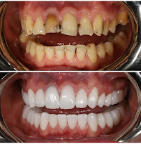 Zirconium Dental House